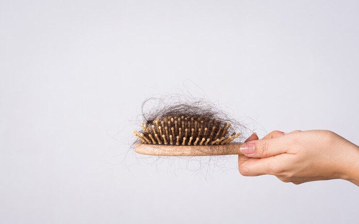 Comb with hair strands, illustrating hair loss in women and the challenges of prevention